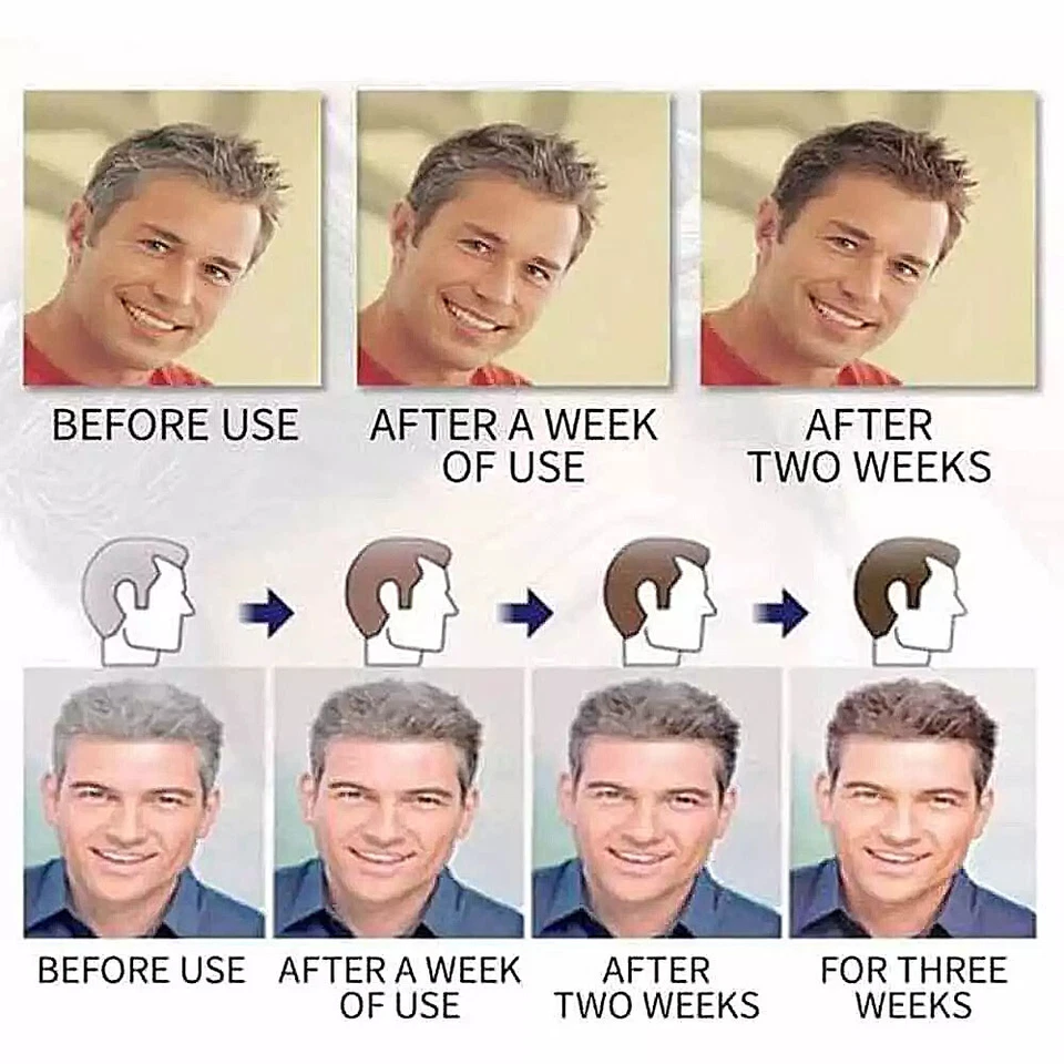 1-5PCS Restoria Discreet Grey Hair Color Restoring Cream Treatment Unisex 250ml - image 3 of 4