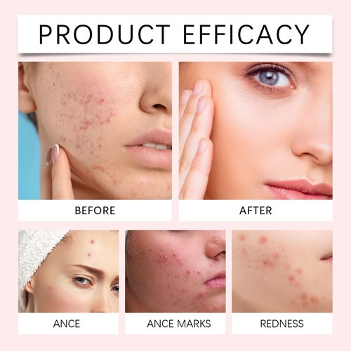 Nano Patch Natural Skin and Face Care Patch, Kubozn Pro MicroDarts Patch - Picture 12 of 14