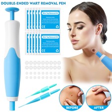 2-in-1 Micro Auto Skin Tag Remover Pen Tool Kit Painless Wart Skin Tag Removal