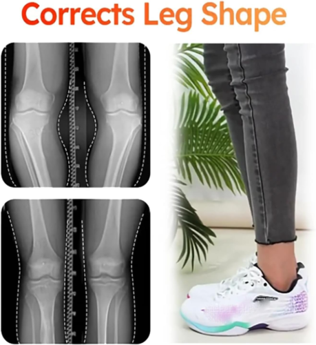 Steppers 4D Technologie Einlegesohlen Rücken Fersenschmerzen Behandlung von Plantarfasziitis - Bild 5 von 14