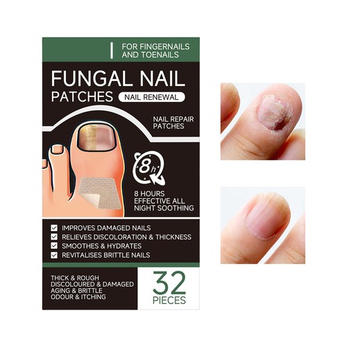 32 Piezas Cinta Fortalecedora Ultra Delgada Restaura Parches de Uñas Fun-gal Cuidado de los Pies - Imagen 3 de 12