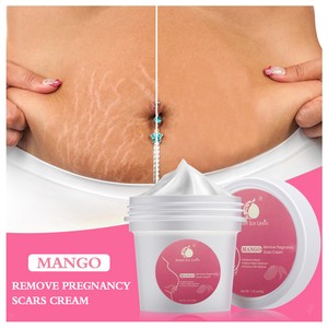 mango stretch mark cream