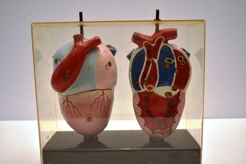 Vintage Anatomical Heart Model in Acrylic Case Educational Medical Display Rare - Picture 8 of 12