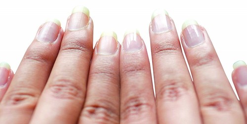 emjoi Micro Nail Electric Nail Polisher - Picture 4 of 6
