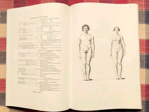 Seltene Faximile Maygrier NOUVELLES DEMONSTRATIONS D'ACCOUCHEMENS Béchet 1822 - Bild 16 von 23