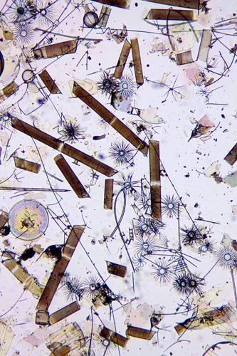 Antique microscope slide. Diatoms. Bacteriastrum, Rhizosolenia, Choetoceros.