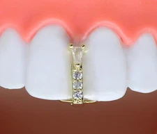 Thin Cubic Zirconia Gap Grillz 14k Gold Plated Teeth Top or Lower Grill + Mold