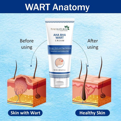 7 Days Genital Wart Removal Cream for Men & Women 100g - Picture 8 of 8
