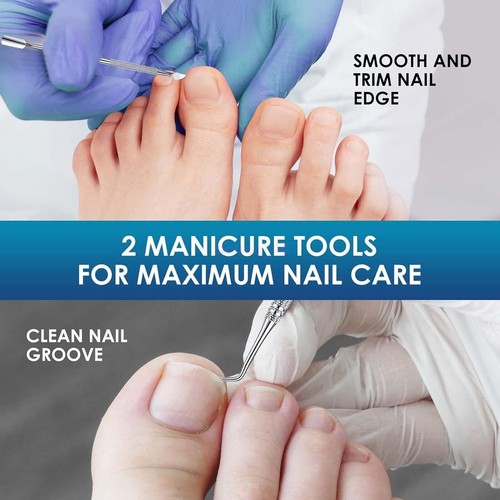 HOT Nail Correction Sticker Ingrown Toenail Corrector Patch Treatment Recover - Picture 5 of 17