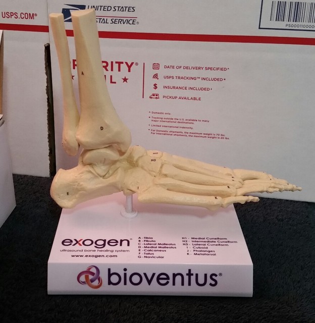 Exogen Ultrasound Bone Healing System Bioventus Plastic Skeleton Foot Display Exogen Ultrasound Bone Healing System Bioventus Plastic Skeleton Foot Display