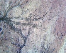 Motor Nerve Endings and Plates, Mammalian; Whole-mount