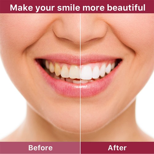 2X SP-4 Probiotic Toothpaste, Sp-4 Toothpaste Ultra Whitening Teeth Oral Fresh - Picture 13 of 18