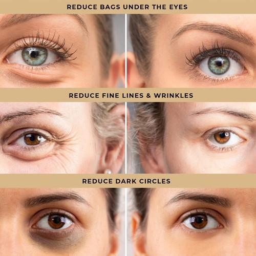 Instant Firm Eye Tightening Cream: Temporary Eye Bag Removal Tightener for Un... - Picture 3 of 7
