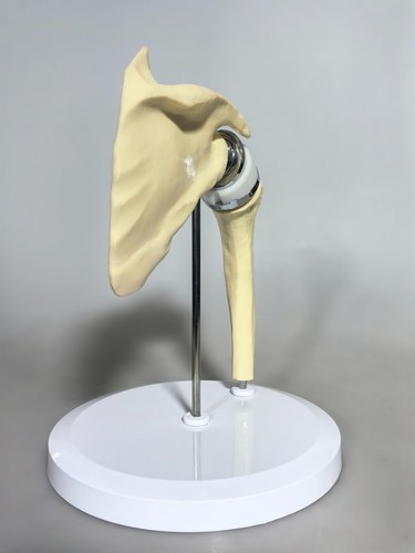 Artificial Shoulder replacement Anatomical model Knee Shoulder Elbow joint model - Picture 9 of 47