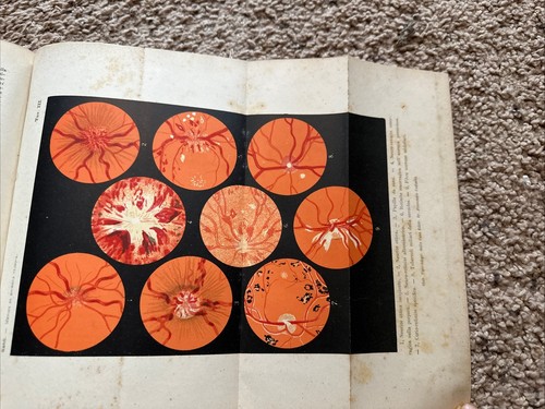 1910er Herman Sahli klinisches Untersuchungshandbuch für Ärzte Farbplatten Leder medizinisch - Bild 7 von 8