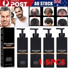 1-5X Root Activator Shampoo, SPARTAN Hair Loss Shampoo,Shampoo Root Activator AU