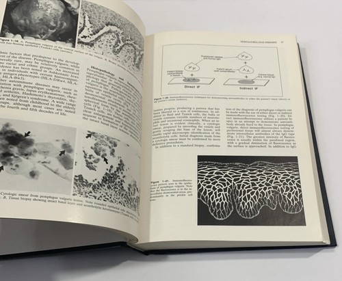 Oral Pathology: Clinical Pathologic Correlations 1989 Hardcover Regezi & Sciubba - Foto 11 di 13