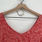 Foto 3 di 11