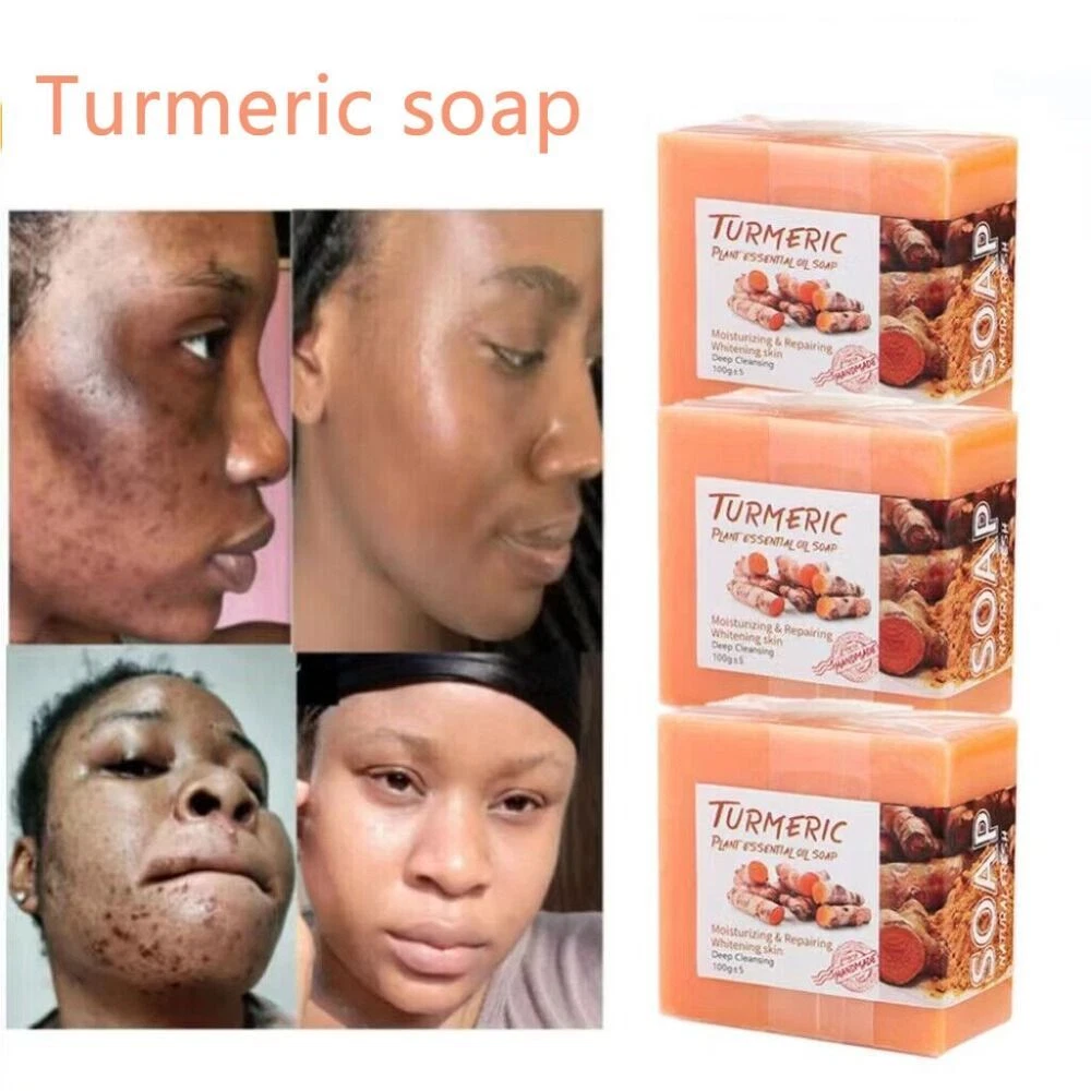 Best soap to remove 2024 dark spots on face