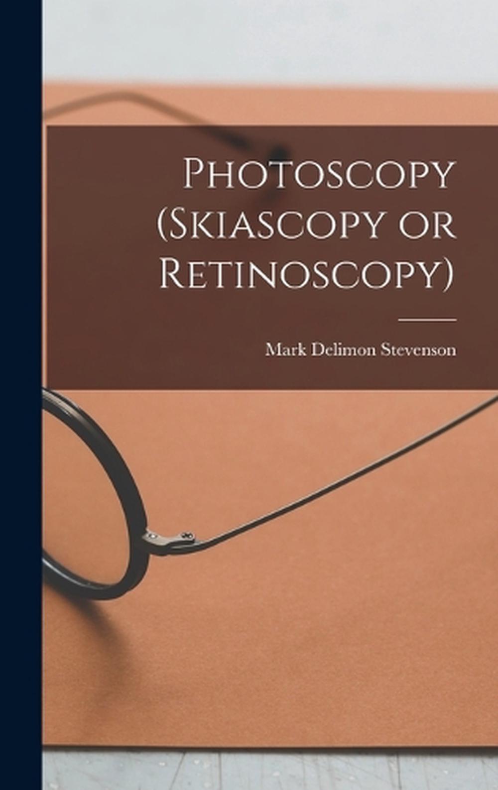 Photoscopy (skiascopy or Retinoscopy) by Mark Delimon Stevenson
