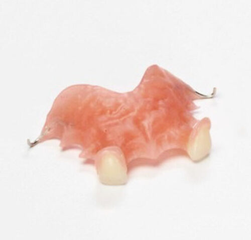 ALETA PERSONALIZADA DE DIENTES PERDIDOS Repuesto dental superior inferior placa - Imagen 2 de 3