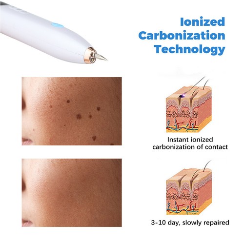 Electric Laser Plasma Pen Mole Removal Dark Spot Skin Wart Tag Tattoo Remover - Picture 9 of 23