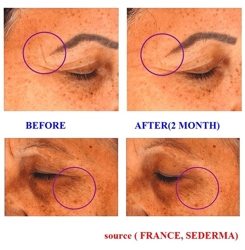 SCM-85 + AHP-8 (10%) + Glutathione & Milk Exosome Lifiting/Firming Ampoule - Picture 4 of 12