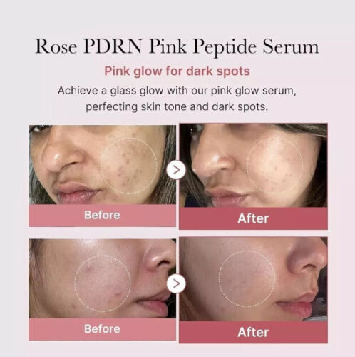 Medicube PDRN Pink Peptide Serum, Niacinamide, Hydrating, Korean Skincare - Picture 2 of 7