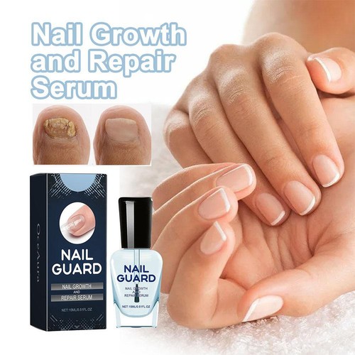 Onyxoguard Siero Crescita e Riparazione Unghie Onyxoguard Rinforzante Crescita Unghie я C9D6 - Foto 5 di 8