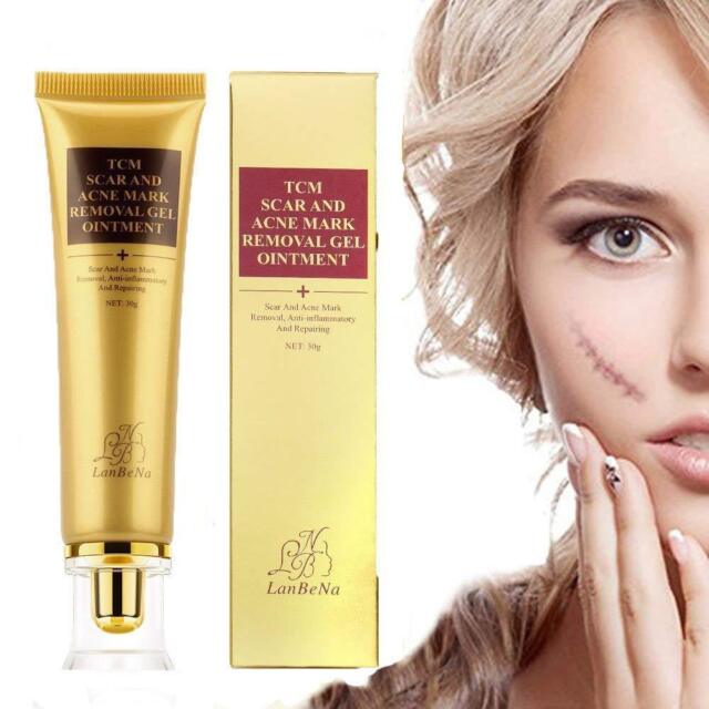 acne scar cream acne scar cream