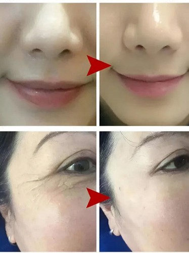 Peptide Anti-Wrinkle Ginseng Serum,Ginseng Essence Water 120ml Anti-Ageing US 🔥 - Picture 8 of 11