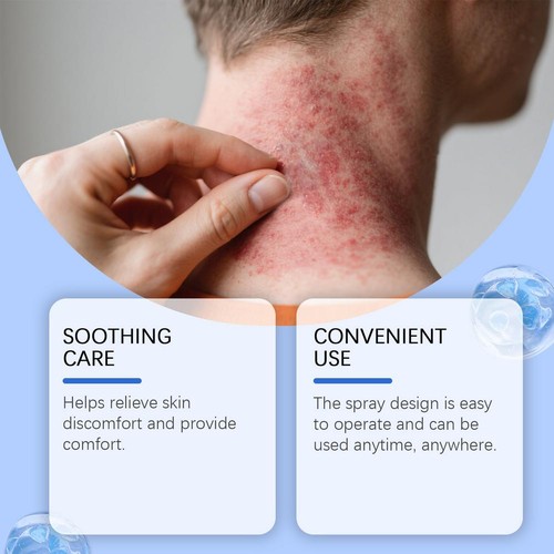 2X Zvoevo Magnesium Herbal Psoriasis Spray For Itching&Intimate AreasRelief - Picture 13 of 17