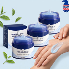 3x Picdo 7-Day Skin Tag Spot Eraser Cream, Advanced Imperfection Removal Cream