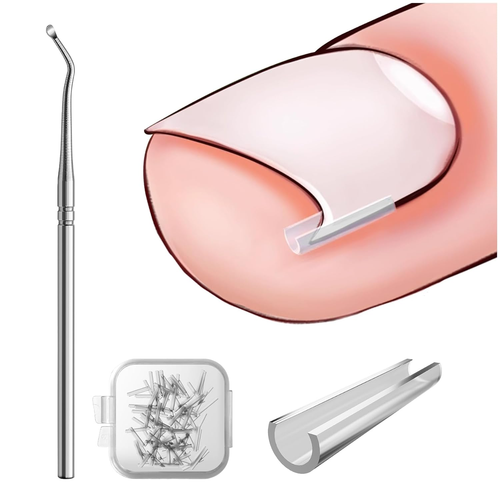 Ingrown Toenail Corrector Set - 40 Pain-Free Straightener Strips with Lifter - Picture 1 of 5