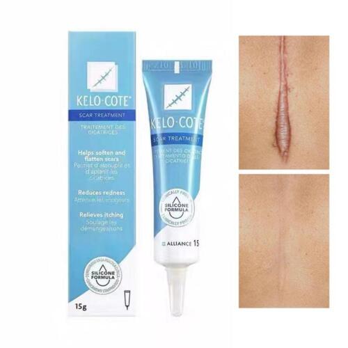Scar Removal Cream For Repairing Burns and Removing ScarsT - Picture 3 of 10