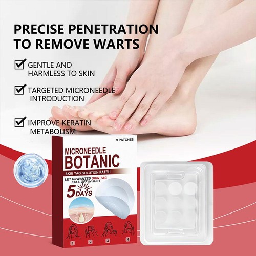 1-5 Box MICRONEEDLE BOTANIC Skin Tag Acne Patch Skin Tag Remover Patches Hot - Picture 5 of 23