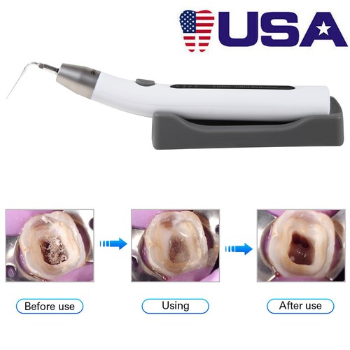 Dental Endodontic Endo Motor /Ultra Activator Irrigator Root Canal Handpiece - Picture 21 of 25