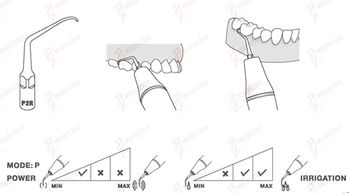 1 punta ZEG Scaler TIP PD2R para *Satelec, * NSK Varios, DTE #Woodpecker original - Imagen 2 de 2
