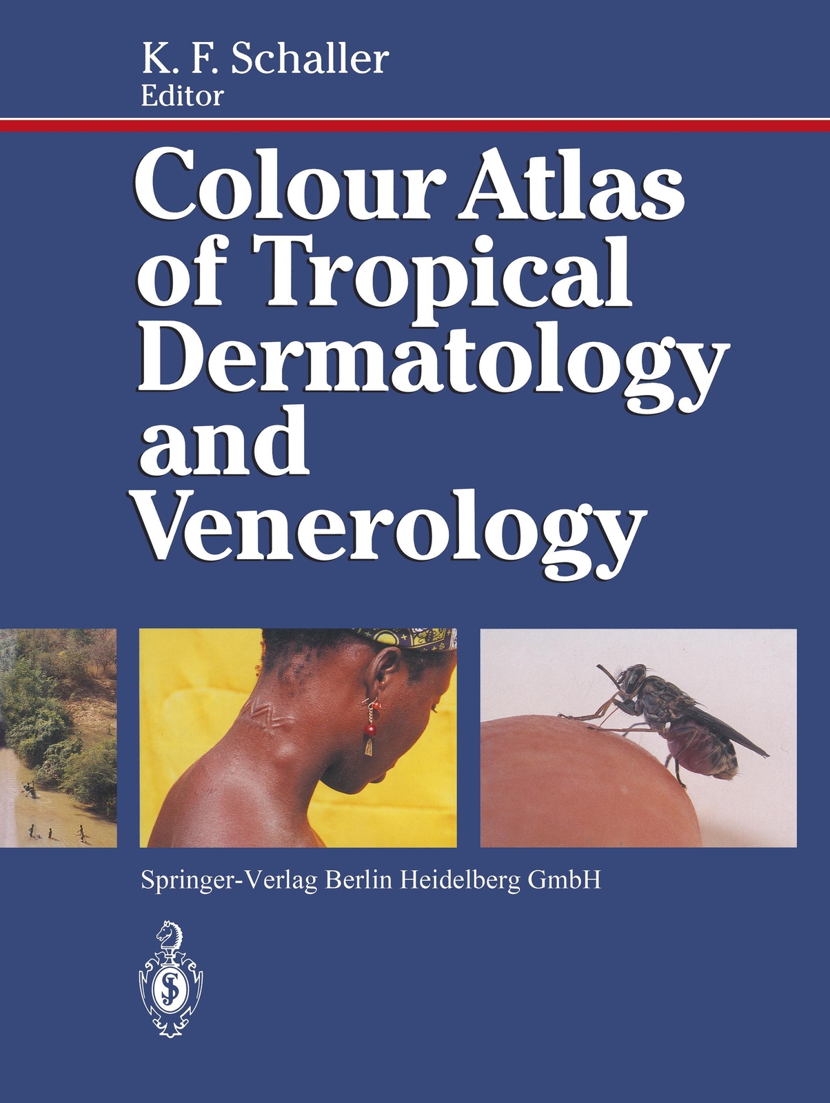 Thumbnail - Colour Atlas Of Tropical Dermatology And Venerology Karl F. Schaller