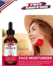 Aceite de rosa mosqueta 100 puro para las arrugas del eccema del acn  2oz