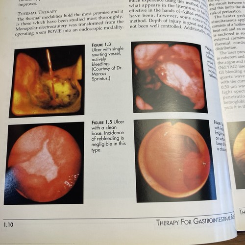 Techniques In Therapeutic Endoscopy Geenen 2nd Edition Photographs Illustrated - Bild 13 von 24