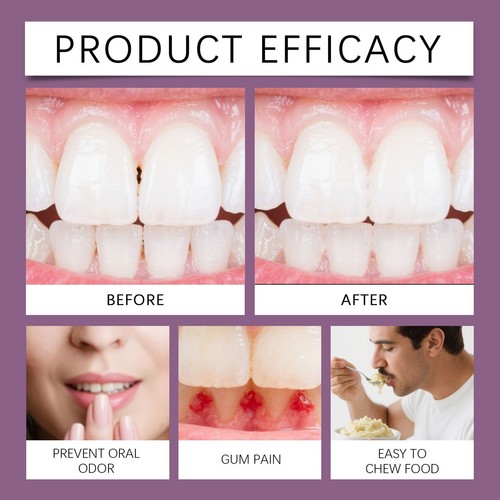 Kleber für Zahnersatz, 40 g, tägliche Reparaturkissen, thermoplastische Prothe - Bild 7 von 12