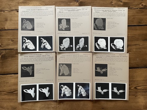 Colección de tarjetas estereoscópicas - ANATOMÍA DE EDIMBURGO VOL 10 CALAVERA Y OREJA - Juego de vista estéreo - Imagen 8 de 12