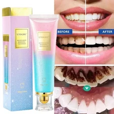 Probiotic Whitening Toothpaste,Nicotinamide OralClean Teeth Whitening Toothpaste