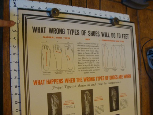 Vintage ORIGINAL Poster: 1937 WHAT WRONG TYPES OF SHOES DO ortho shoes inc. - Picture 2 of 5