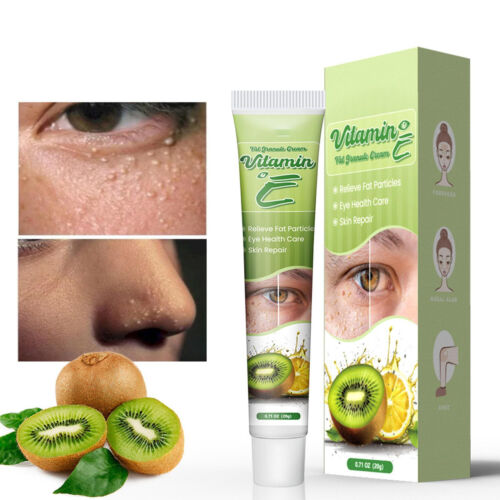 Crema reparadora de ojos hidratante nutritiva para ojos vitamina E grasa gránulos pomada - Imagen 8 de 12