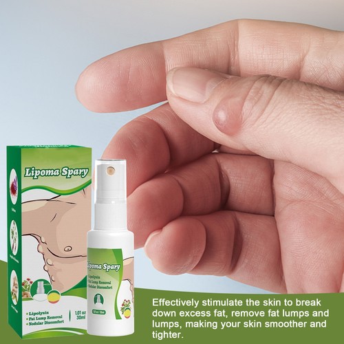 30ml Lipoma Removal Spray Lump Free Lipoma Lipomheilung Reduction Spray - Picture 7 of 12