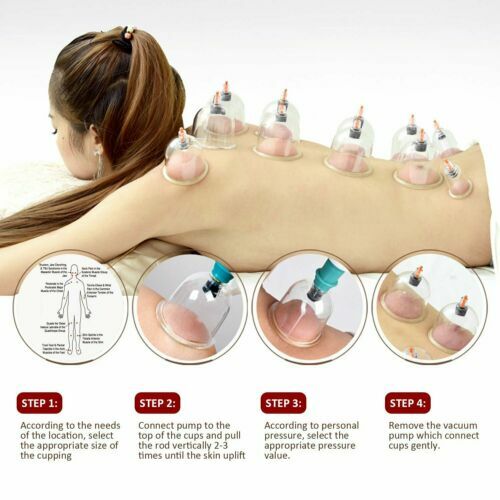 12 Cupping Therapy Cups Set Healthy Chinese Medical Vacuum Suction Body Massager - Picture 3 of 12