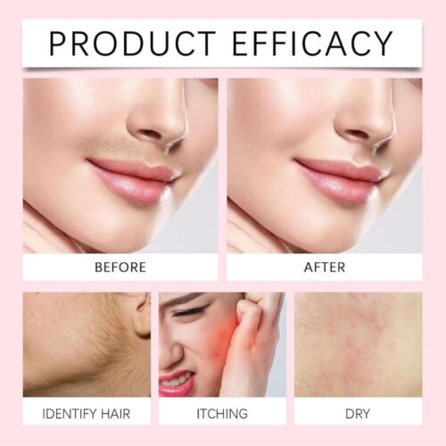 Hair Remover Moisturizing Face Cream, Removes Hair On Upper Lip, Face And Chin - Picture 6 of 12