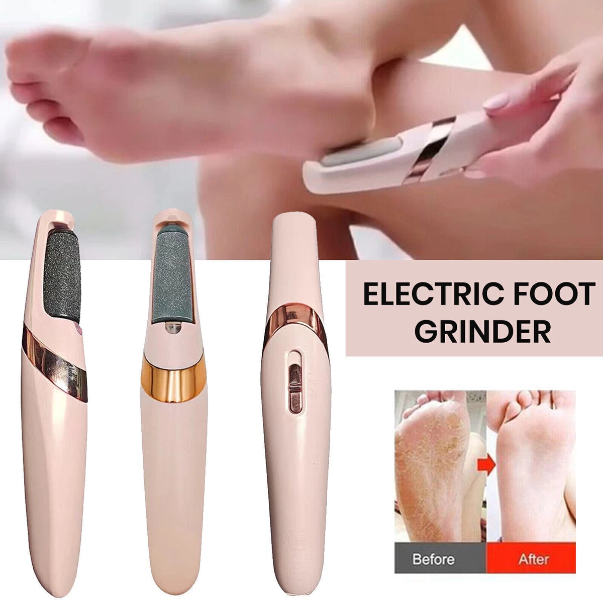 Electric Nail File Kit & Callus Remover (4 in 1) Best Pedicure